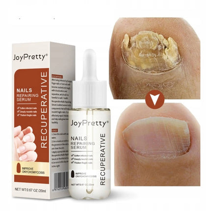 Profesionalus nagų augimą skatinantis antibakterinis preparatas JoyPretty 20 ml manikiūro specialistams