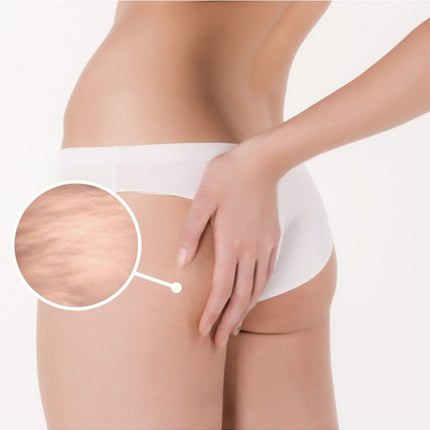 Profesionalus BODY SLIM kremas 500ml lieknėjimo masažui kosmetologijos kabinetuose