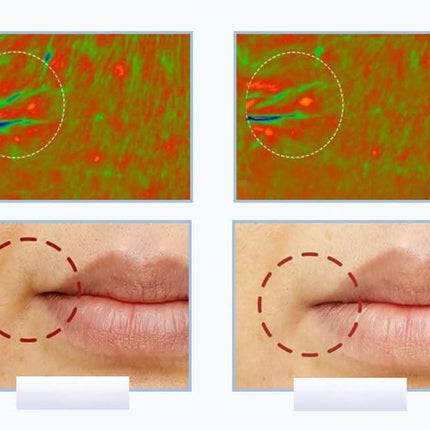 ANLAN veido masažuoklio ultragarsinė galvutė su spalvotos šviesos funkcija – anti-aging procedūroms namuose ir salone